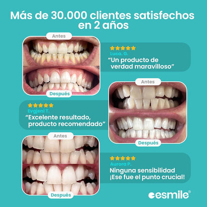 Blanqueador dental UV-PROFESIONAL