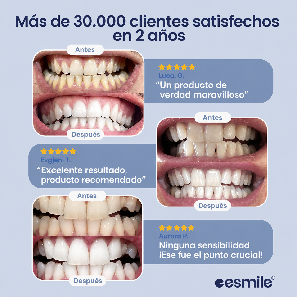 Blanqueador dental UV-PROFESIONAL